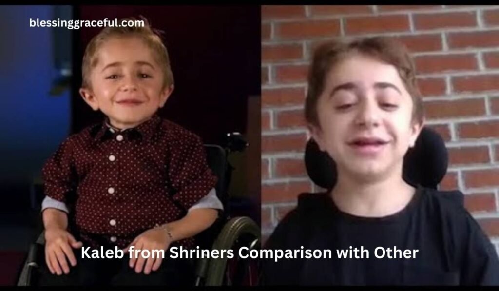 Kaleb from Shriners Comparison with Other